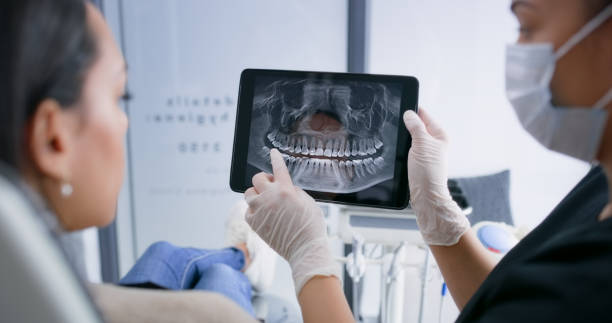 Licensed Tooth Extraction service in Iberia Parish County, LA - Smile Center Dentistry